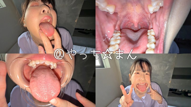 H 1651y00304pl